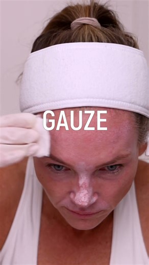 🧴 The safest way to apply chemical peels at home? Always with gauze