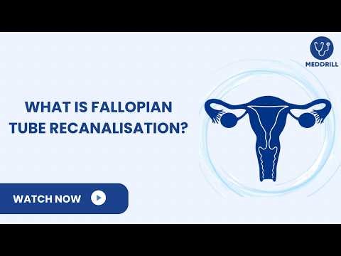 Fallopian Tube Recanalization (FTR) Explained | A Treatment for Blocked Tubes & Infertility