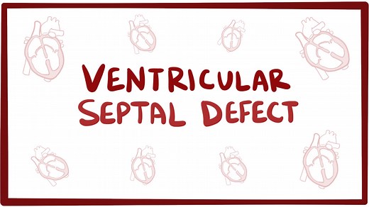 Ventricular septal defect: Video, Causes, & Meaning | Osmosis
