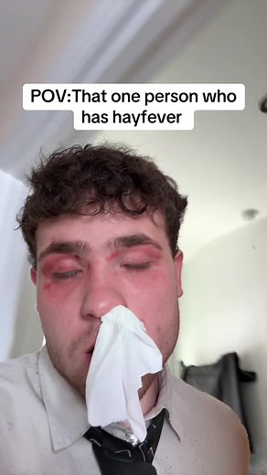 Understanding Hay Fever Symptoms and Relief Methods