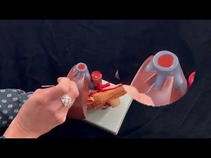 Dr. Benaduce: Blood vessels, Ducts and Sphincter of Oddi (Accessory Digestive Organs - 3D model)