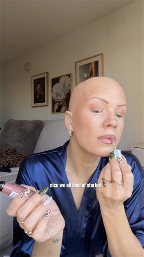 DM me group chat on IG & you’ll be invited to our bald group chat! #baldtourage #alopecia