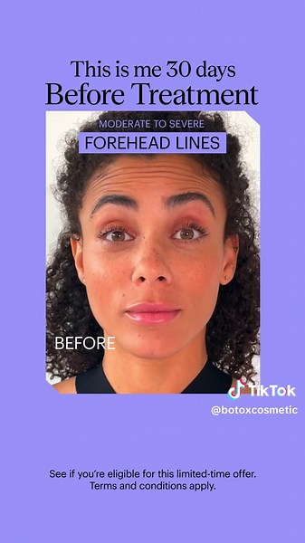 BOTOX® Cosmetic on TikTok