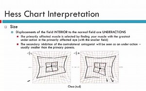 Hess Chart Interpretation-Hess屏解读