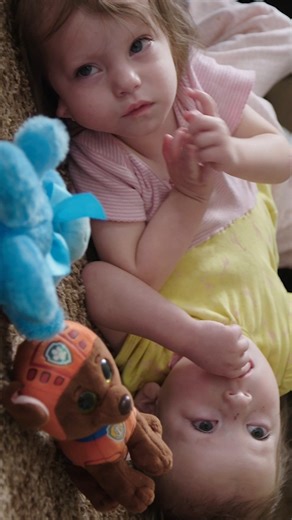Meet conjoined twins Callie and Carter - they're a medical miracle ❤️ | My Extraordinary Family