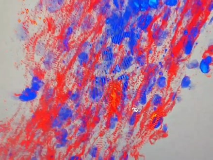 组织透明化后Confocal 3D重建