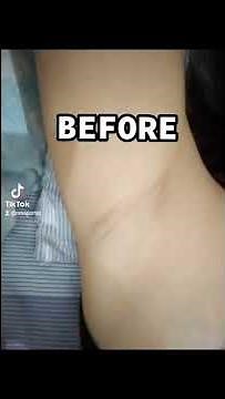 88 TOTAL WHITE UNDERARM CREAM REVIEW
