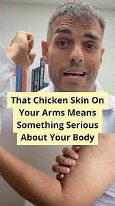 That Chicken Skin On Your Arms Means Something Serious About Your Body