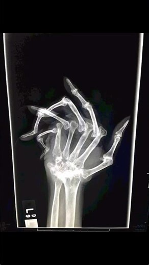 THE WORLDS WEIRDEST X-RAYS PART 2 || #horror #bizarro #creepy #scary #fyp