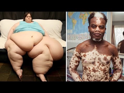 15 Unusual People You Need To See To Believe