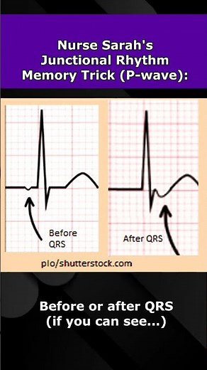 Junctional Rhythms ECG Nursing Mnemonic NCLEX EKG Review