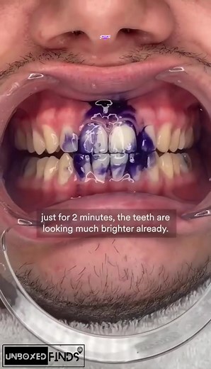 Unlock Your Best Smile with V34 Colour Corrector