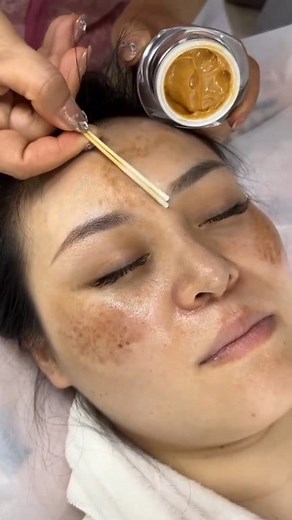 255K views · 1.2K reactions | ✅ Dark Spots Removal At Home/Pigmentation & Dark Spots Remove . . . #skincare #darkspots #pigmentation #pigmentationsolution #spotlessskin #glowingskin #antiaging #facebookreel #reelsfypシ #reelsfbシ #fbreelsfypシ゚viralシ #fbreelsfypシ゚ #reelschallenge #explorepage #everyonefollowers | Natural Beauty Remedy | Facebook