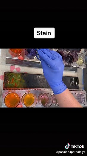Understanding Frozen Section in Pathology