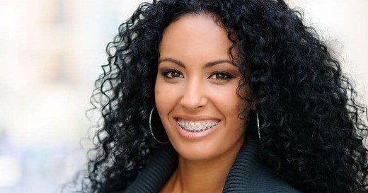 Spacers for Teeth: What Are They and Are They Painful? - Dentaly.org