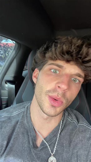 Beard Tryout After Wisdom Teeth — Keep or Trim?