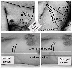 Percussion of Spleen