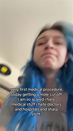 Mole Removal Process: My First Medical Procedure Experience