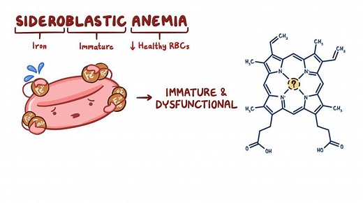 Video: Sideroblastic anemia - Video Explanation! | Osmosis | Osmosis