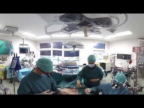 360 degree Video of a Heart Valve Operation in the Heart Center Leipzig (Helios)