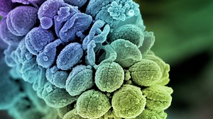 What’s a species? The typical approach for cataloging organisms doesn’t work very well for bacteria. Microbiologists are instead working to categorize bacterial organisms through a genomic study of the functions that they perform. https://www.quantamagazine.org/the-quest-for-simple-rules-to-build-a-microbial-community-20240117/ | Quanta Magazine