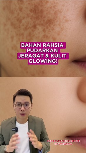 Manfaat L-Cysteine untuk Cerahkan Kulit