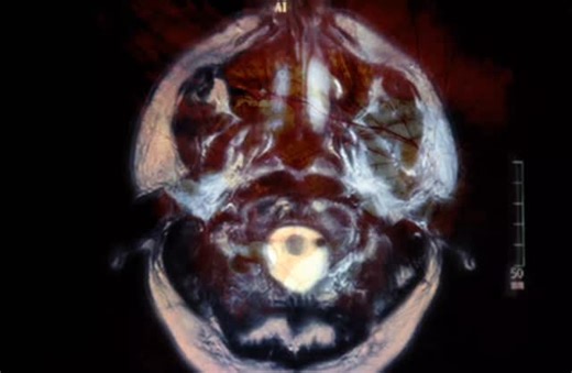 ⠀ on Instagram: ". Credit/TT:eviek052 Nokia Angel began gaining attention through an aesthetic built around nostalgia, minimalism, and early-digital culture. Inspired by early 2000s technology, old Nokia ringtones, ambient textures, and internet-era melancholy, Nokia Angel represents a sound and visual identity that blends retro emotions with modern online culture. Rather than focusing only on mainstream structures, Nokia Angel’s work leans into atmospheric tones, distorted melodies, and emotion