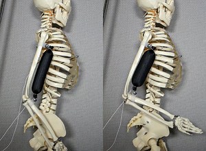 3D printed synthetic muscle is up to three times stronger than human tissue