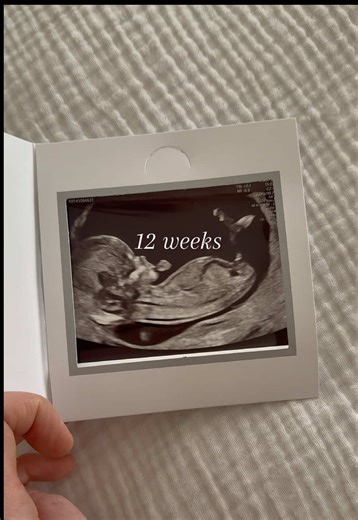 My 12 Week Pregnancy Scan Experience