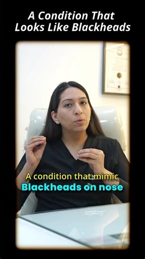 Not All Blackheads Are the Same - A Condition That Looks Like Blackheads