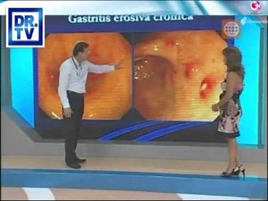 Gastritis - what it is, causes, symptoms and treatment