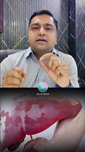#stress सिर्फ दिमाग की नहीं, शरीर की बीमारी है | Stress Truth in Hindi #destressed
