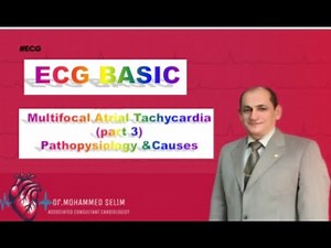 Multifocal atrial Tachycardia part 3