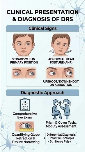 Decoding Duane’s Retraction Syndrome (DRS) in 5 slides! 📊👁️