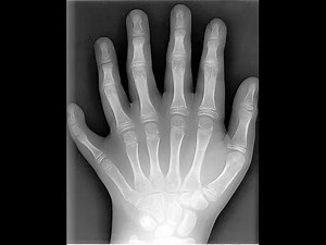 Chuck Missler Genesis Session 11 Ch 6 (The Days Of Noah)