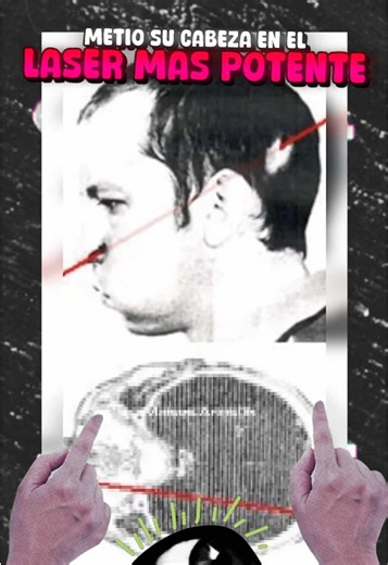 Científico ruso metió su cabeza en el láser más potente 💀 | laser