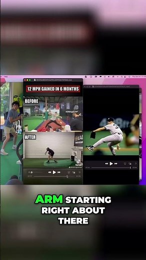 Understanding Valgus Stress: Impact on Elbow Health