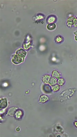 Macrophages present antigens to activate the adaptive immune response! #microscopy #biology #nature
