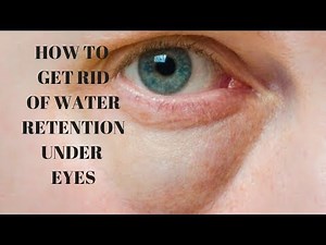 how to get rid of water retention under your eyes