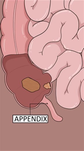 This Small Thing Causes So Much Pain