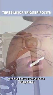 Are Teres Minor Trigger Points Causing Your Shoulder Pain?