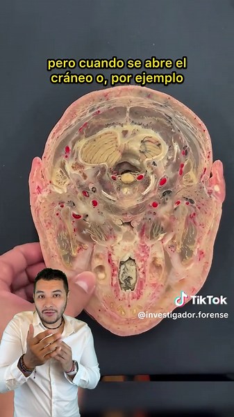 Así se ve la cabeza por dentro 💀 #pontecrimi #aprendeentiktok | normal head vs flat head