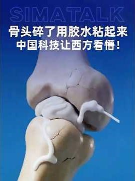 骨头碎了真能“粘”起来？中国研发骨粘合剂，骨折手术迎来革命！#中国科技 #医疗创新 #生物材料 #骨折 #手术革命