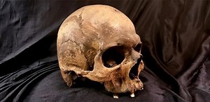 With Ancient DNA, Scientists Have Mapped 37,000 Years of Disease Across Europe and Asia