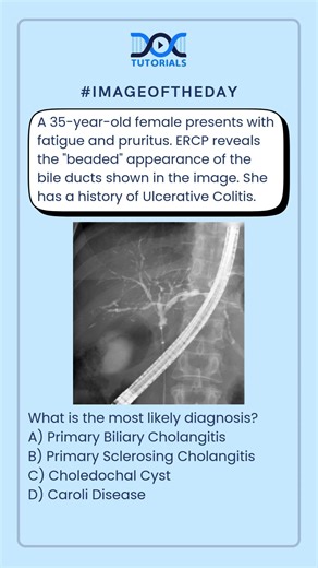 What is the most likely diagnosis?