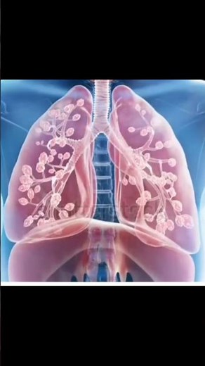 Pneumothorax, hemothorax, empyema, and pleural effusion 🫁
