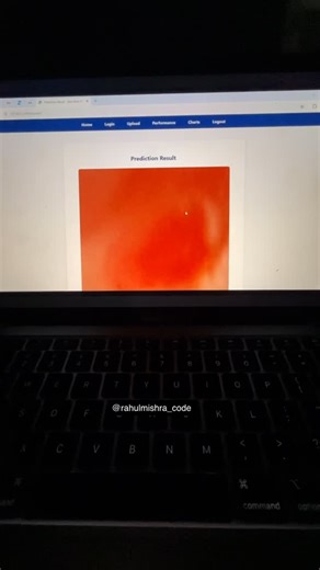 Rahul Mishra Code AI on Instagram: "AI-Based Skin Burnt Prediction Using Python | Final Year Project 2025 Features:- Watch the demo of an AI-powered Skin Burnt Prediction system developed using Python. This project helps classify skin burn severity and suggests treatment options — perfect for final year biomedical or AI projects. ⚙️ We customize projects as per your syllabus and provide 24×7 support for doubts and guidance. 📞 If You Want This Project And To Successfully Run This Project In Your