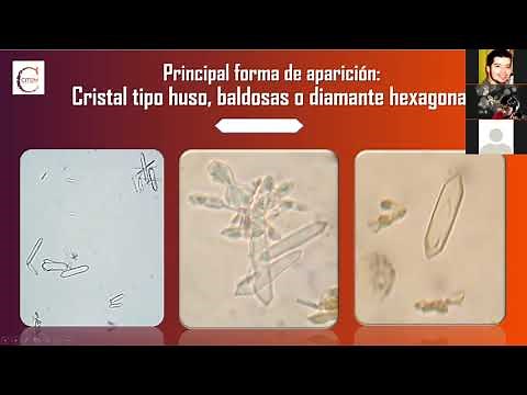 APRENDE Y CONOCE los cristales en orina MENOS COMUNES 💎🧪