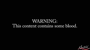 It's time that we found out the truth behind a PRP Vampire Facial! Radiance Aesthetics & Wellness Learn more > http://bit.ly/2u4FCSD | Spa Week Media Group