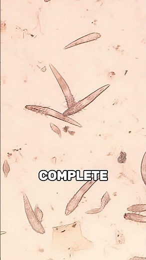 Face Mites Explained